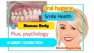 Dental Blogger Dr Dinesh Karki